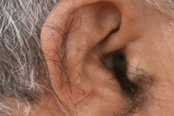 Pourquoi de plus en plus de personnes ont des poils sur les oreilles avec l’âge