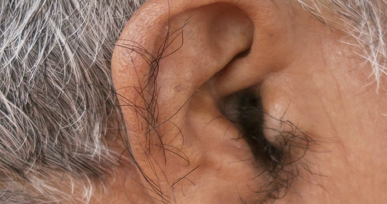 Pourquoi de plus en plus de personnes ont des poils sur les oreilles avec l’âge